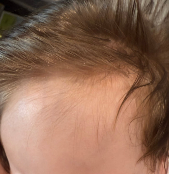 After: Baby's now smooth skin