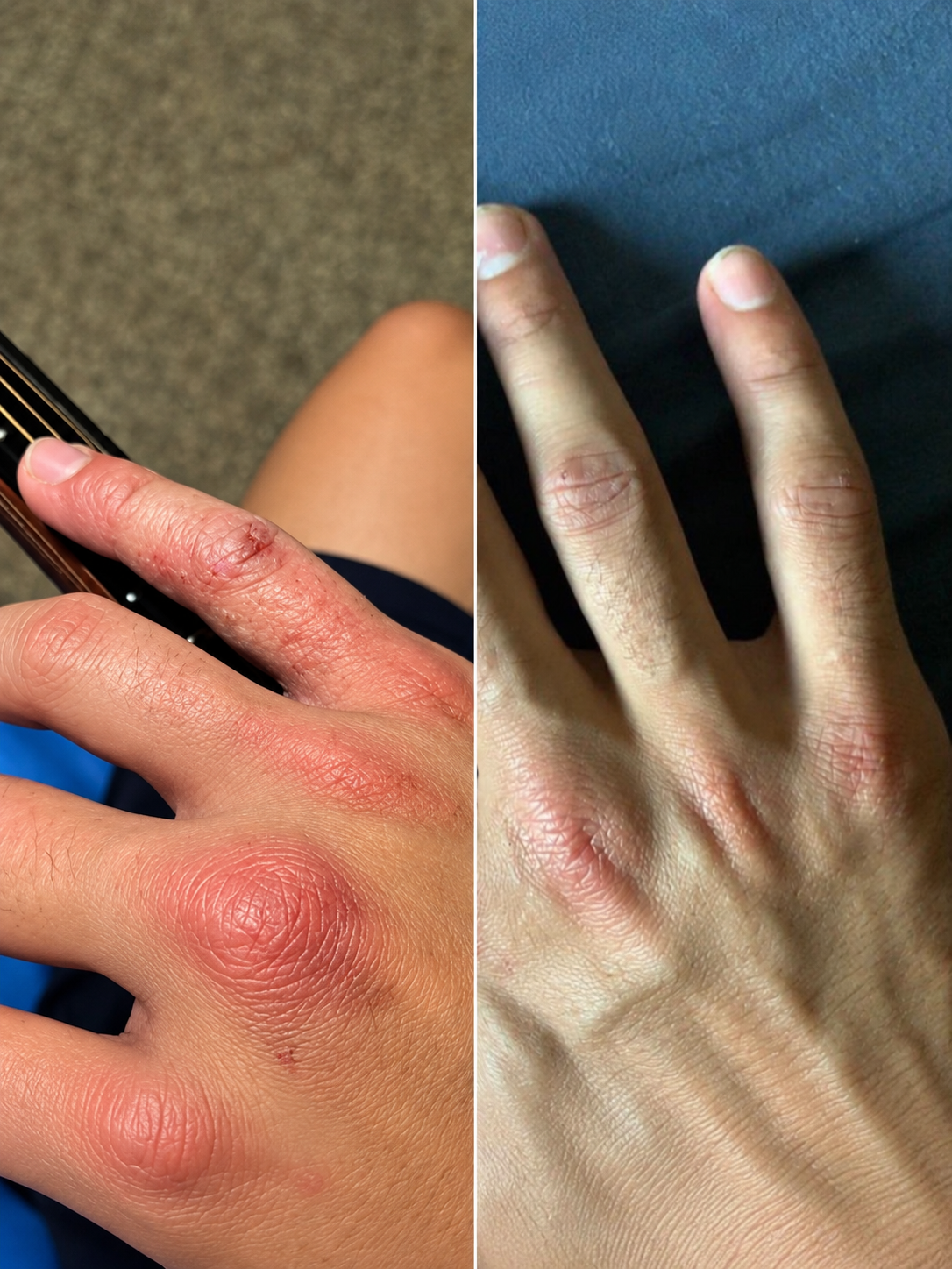 Natural skincare for eczema-prone skin