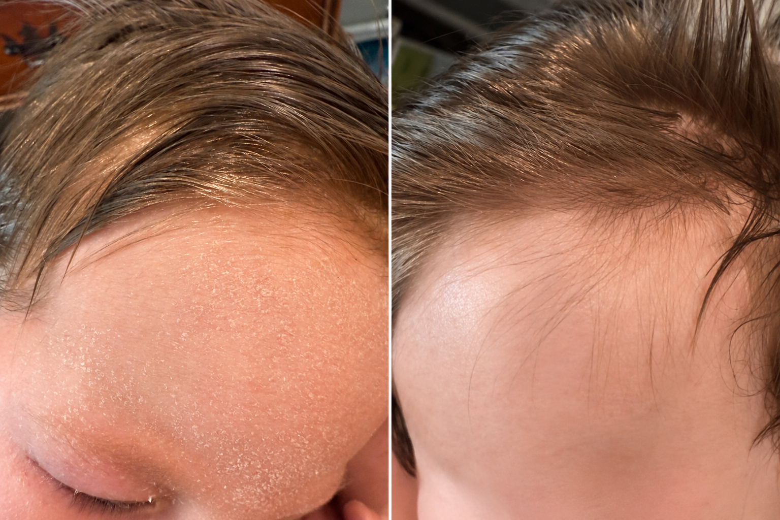 Natural skincare products for very dry skin